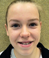 Lipp, Hanna