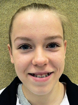 Lipp, Hanna