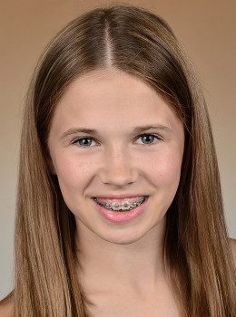 Bauer, Valentina