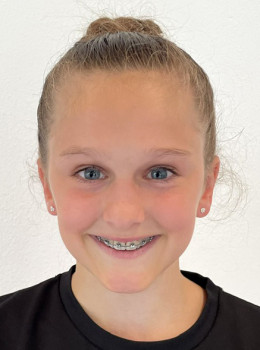 Glaser, Anna