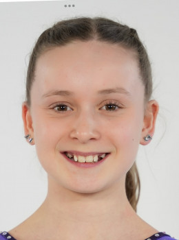 Albrecht, Anna
