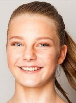 Beekhuis, Esmee