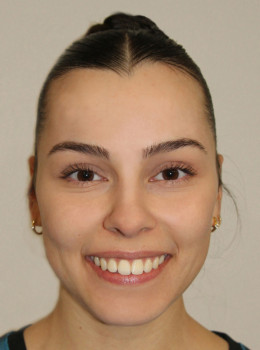 Lauser, Leonie