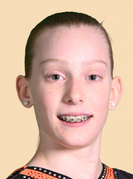 Brenneisen, Emilia
