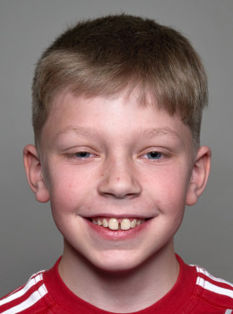 Schmirander, Lucas